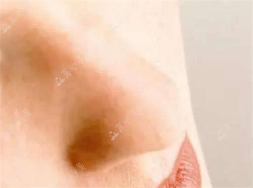 温州超声炮多少钱一次?超声炮抗衰项目价格8K~1.5W起靠谱吗