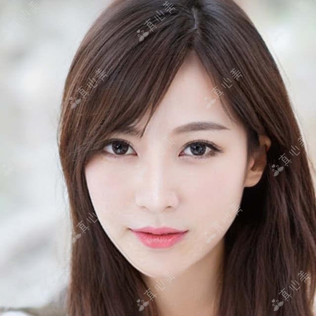 武汉同济医学院医院医美价格|整形项目费用明细:双眼皮手术 5800