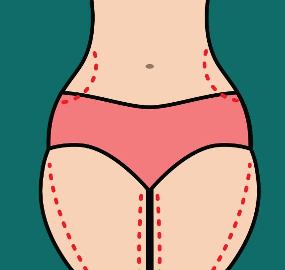 十四、大腿吸脂手术:13000元起,适合希望改善大腿线条的人群