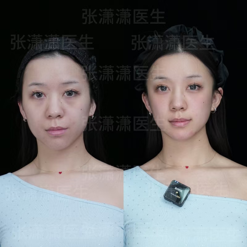 八、北京画美医疗美容医院