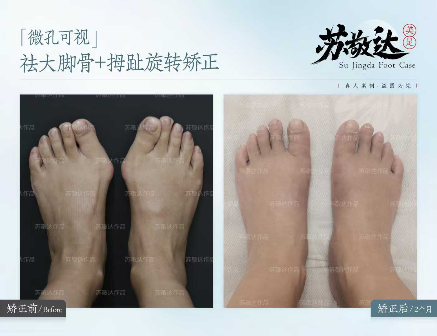 六、北京圣嘉新医疗美容医院