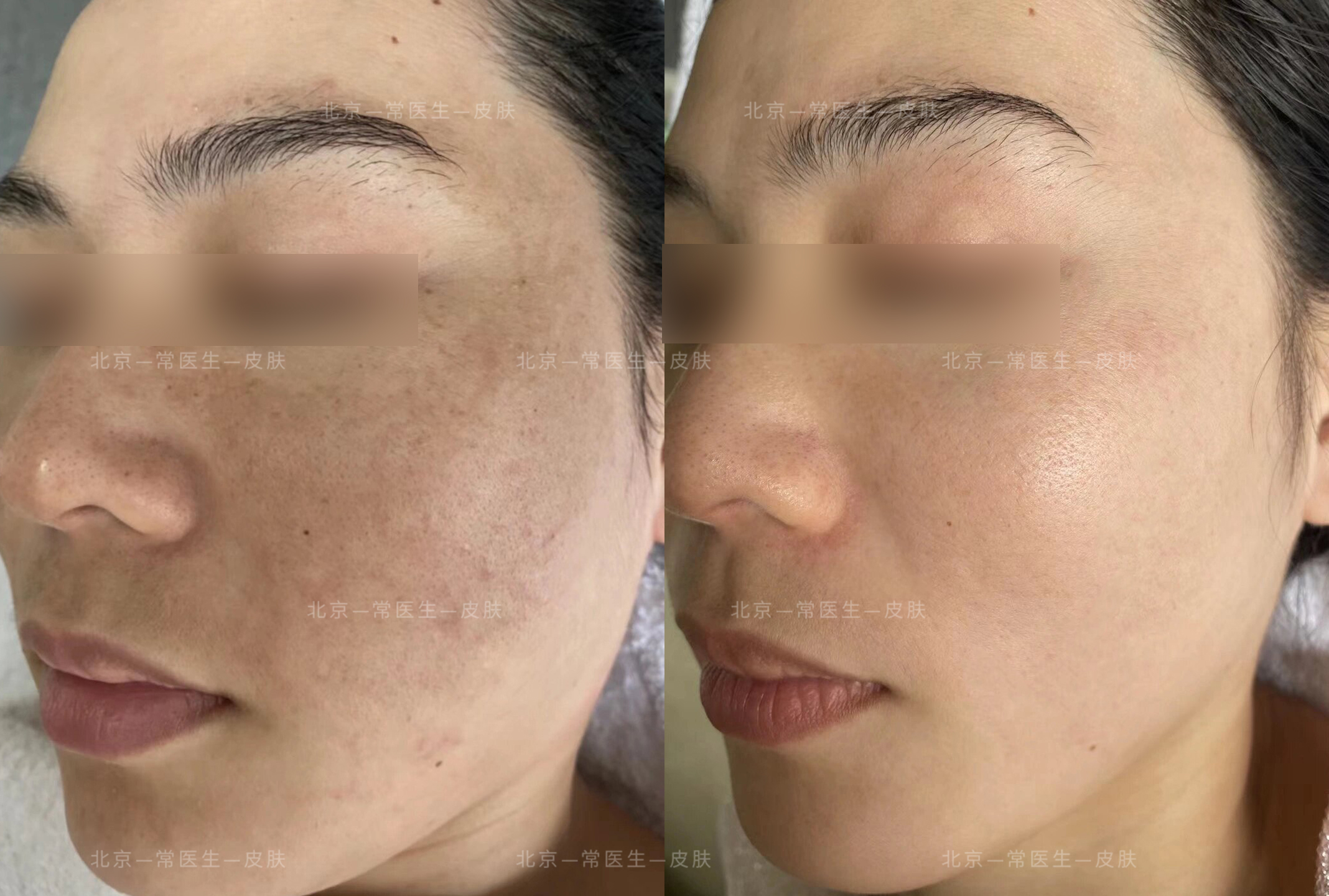 北京哪家整容医院好？2026年口碑稳的米兰柏羽、华韩、伊美尔更值得选！