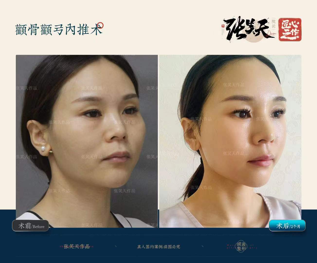 八、北京圣嘉新医疗美容医院