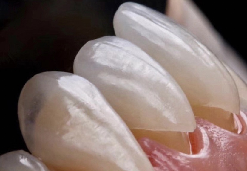 二、包头市微笑臻吻口腔门诊部