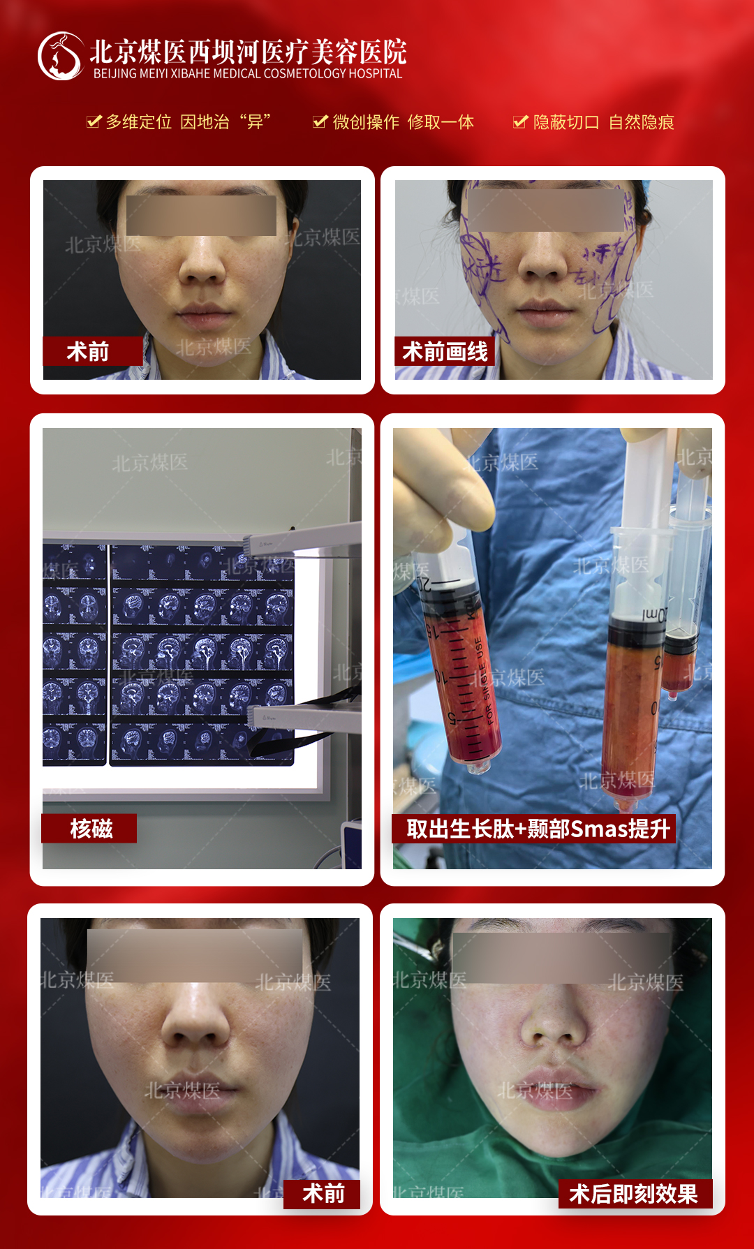 九、北京煤医医疗美容医院