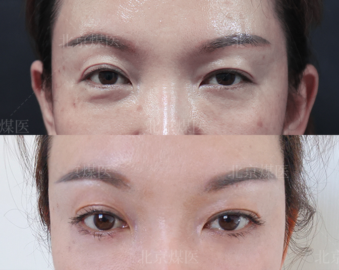 九、北京煤医医疗美容医院
