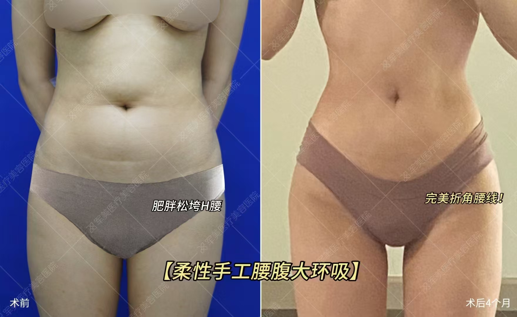 十、广州军美医疗美容医院