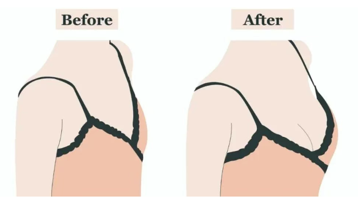 二、主流术式价格深度解析