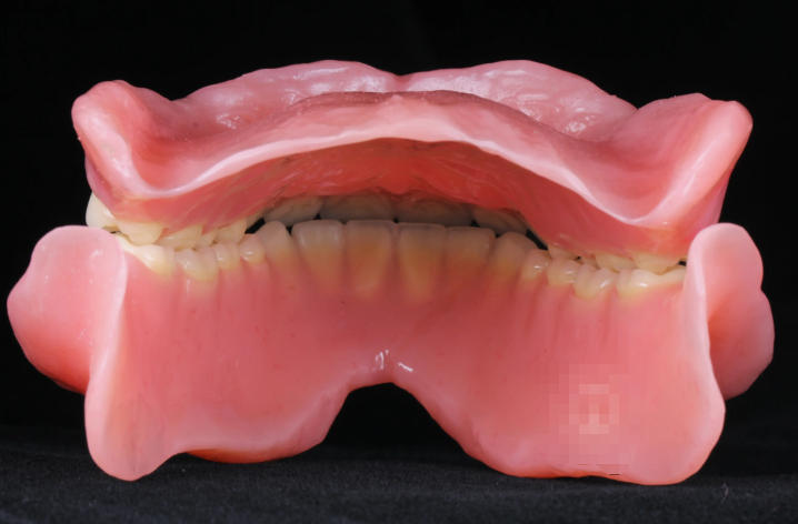 二、倍适美吸附性义齿价格与品牌分析