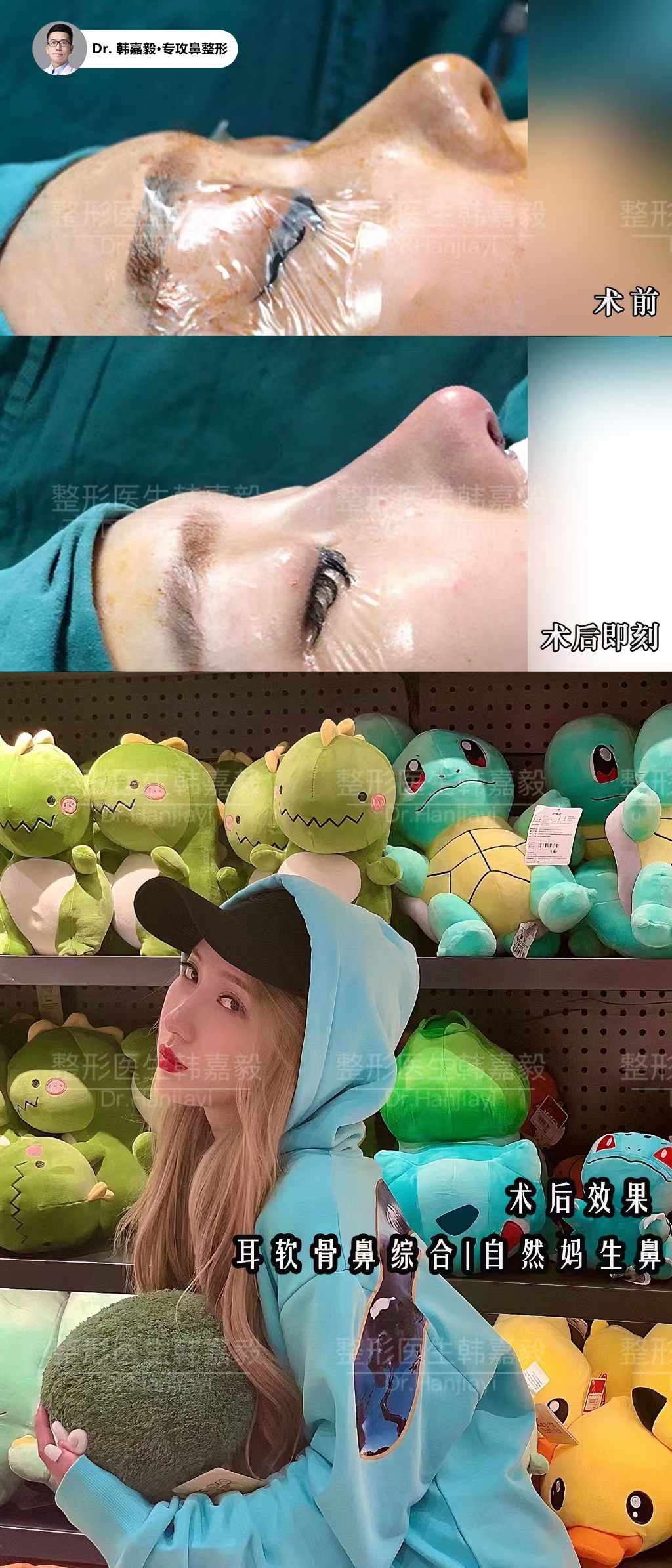 上海那家医院可以做拉皮？伯思立、华美、悦目佳容更受关注