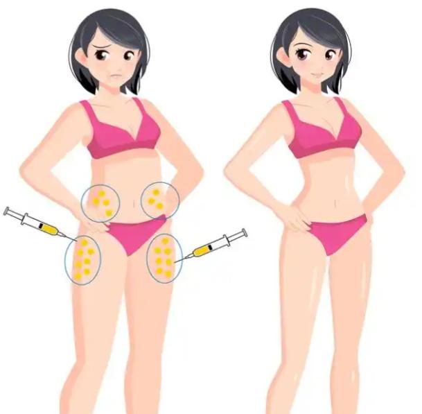 三、吸脂肪手术多少钱｜避坑指南与理性选择建议