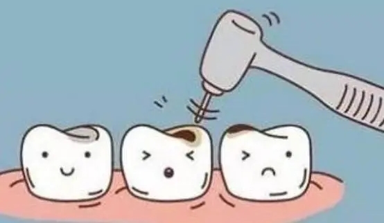 五、树脂补牙的适用人群和场景