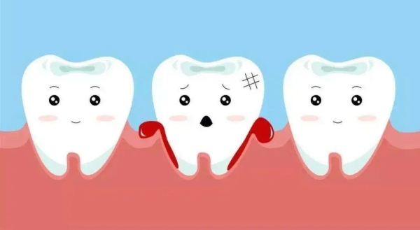 七、树脂补牙的注意事项