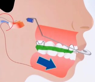 四、注意事项：选择时需考虑的细节