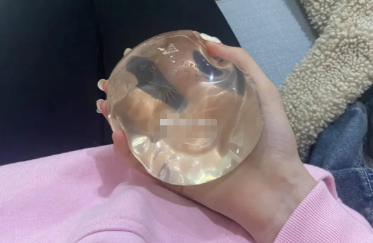 二、上海隆胸手术费用的构成