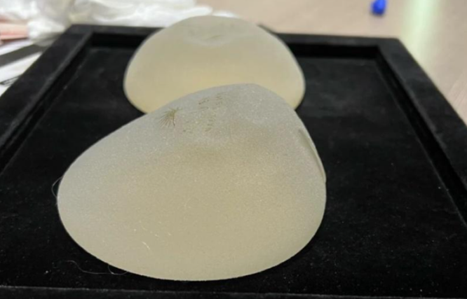 上海隆胸要多少钱？2026年上海整形医院价格参考全解析！