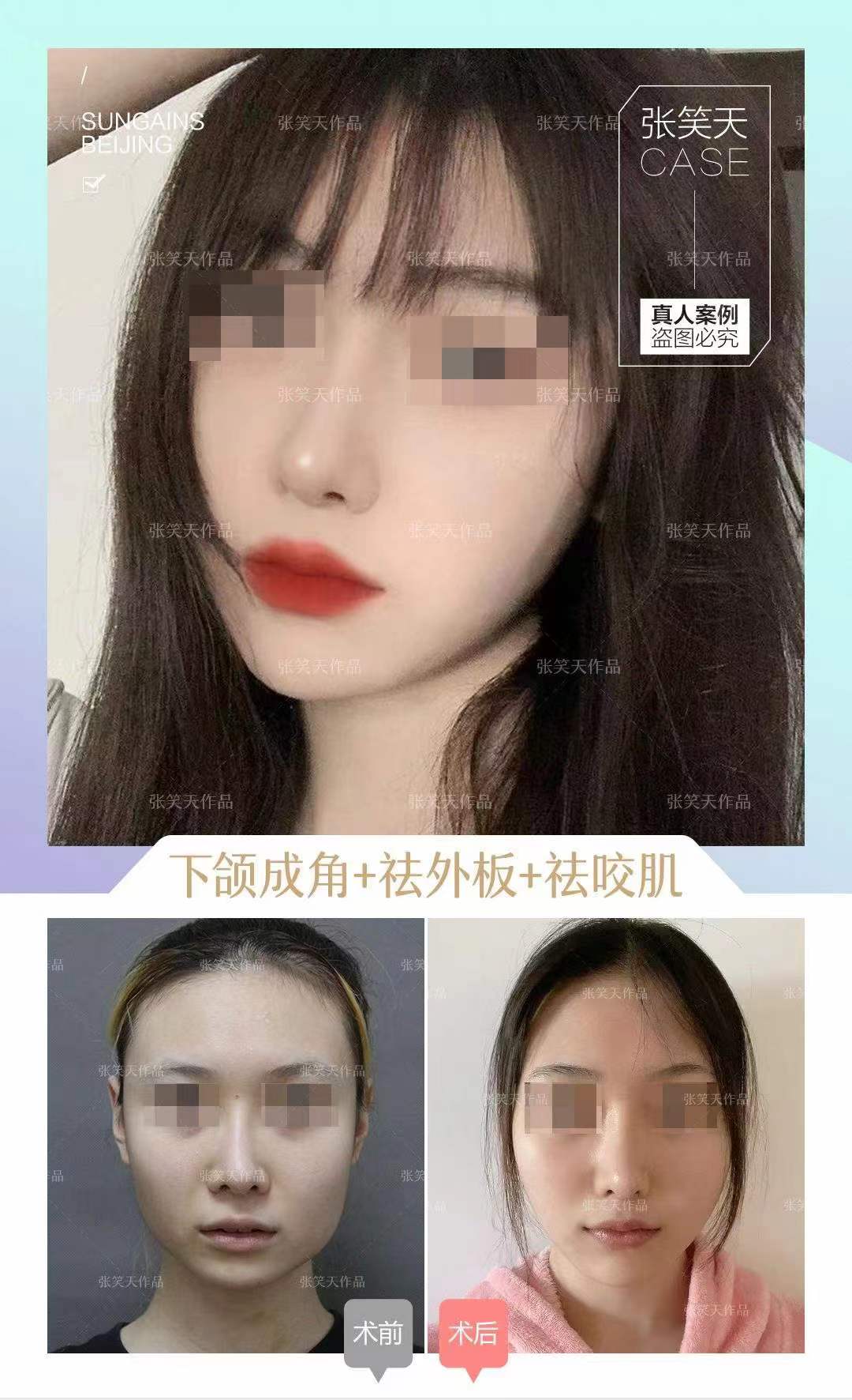 三、北京圣嘉新医疗美容医院是吗？评级与资质齐全