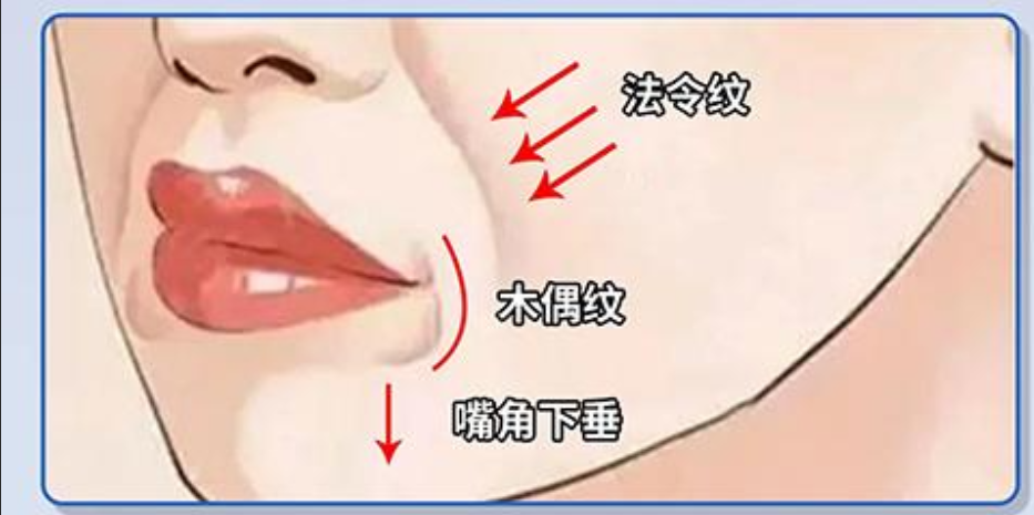 二、治疗方式对口周年轻化维持时间的影响