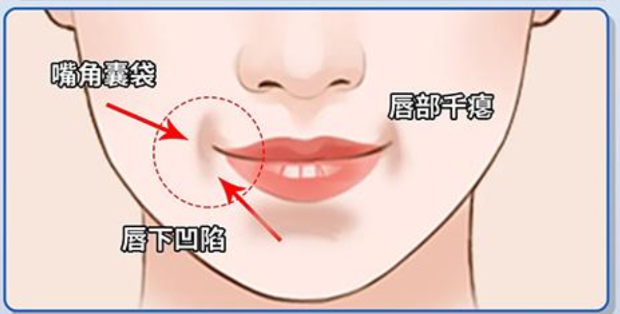 三、影响口周年轻化疗效维持时间的其他因素