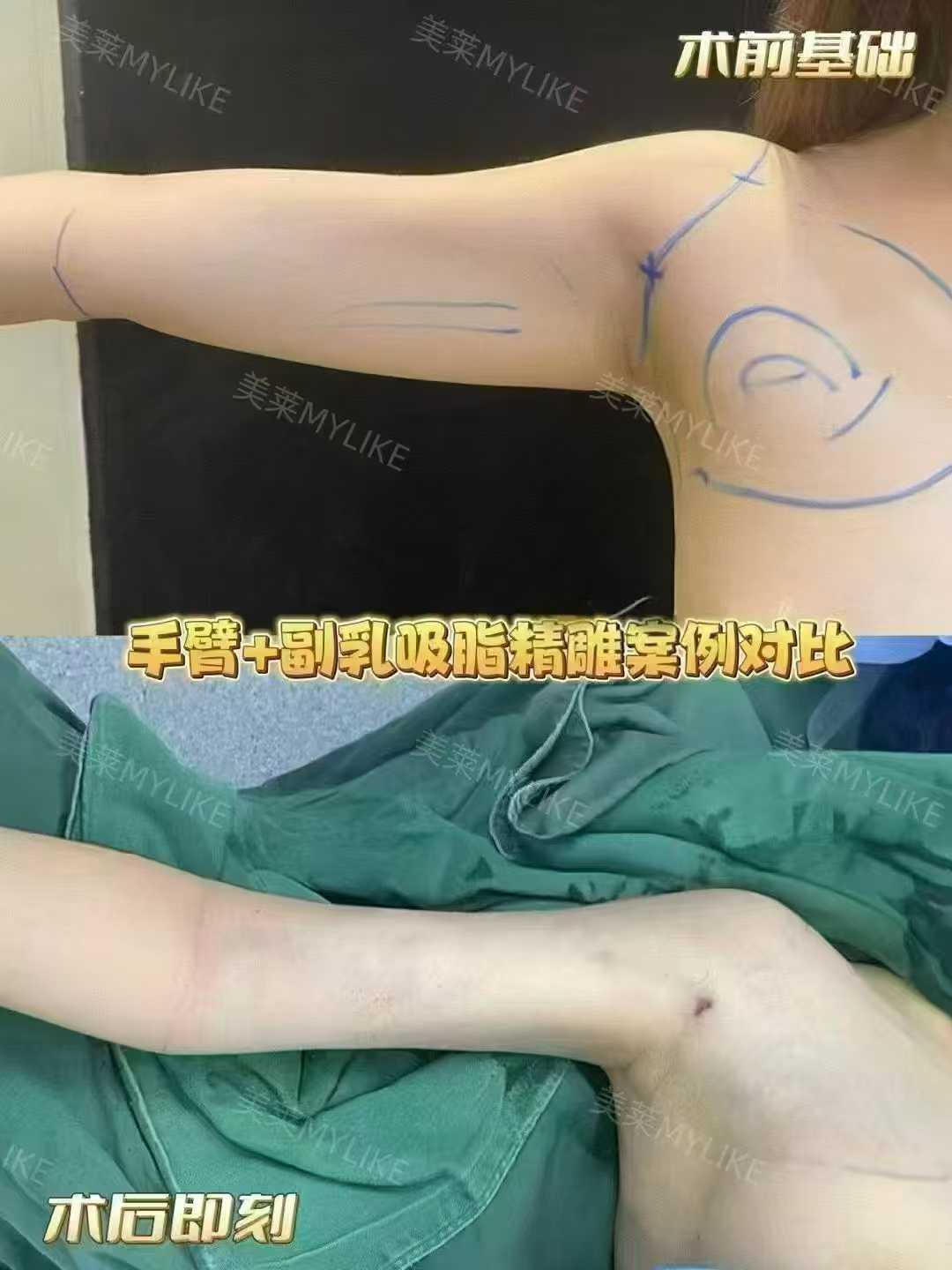 二、石家庄美莱医学美容医院