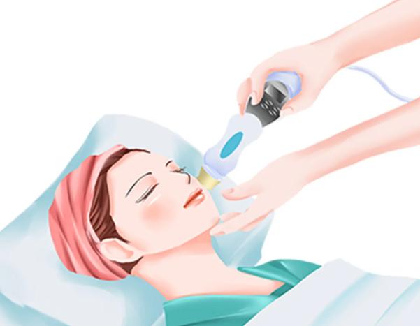 十、石家庄点阵激光价格参考