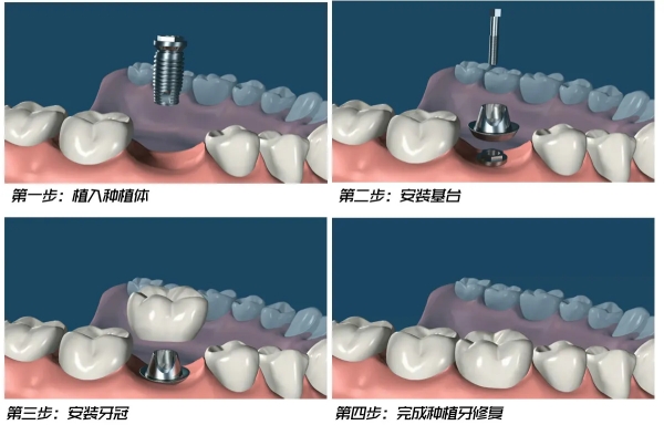 五、石家庄蓝天医院治疗疗效，科学治疗与术后护理并重
