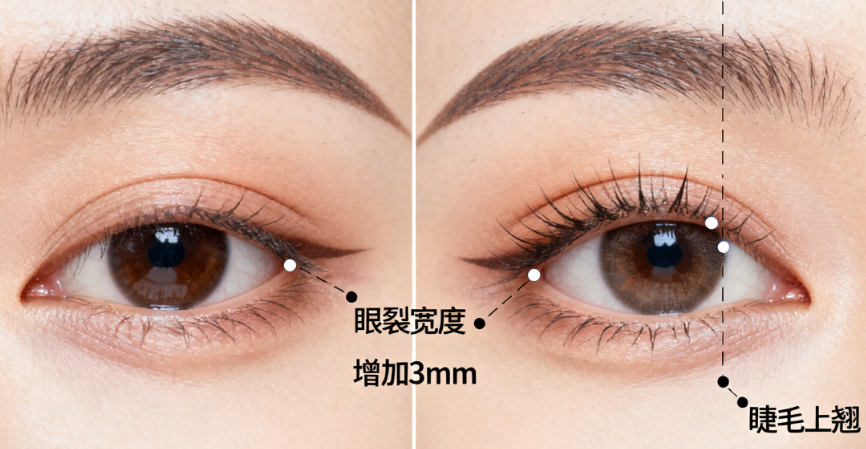 二、武汉陈平双眼皮较比较牛三个地方