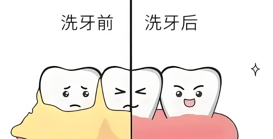 二、不同医院洗牙价格对比