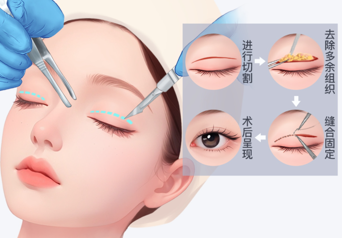 五、如何选择适合自己的方案