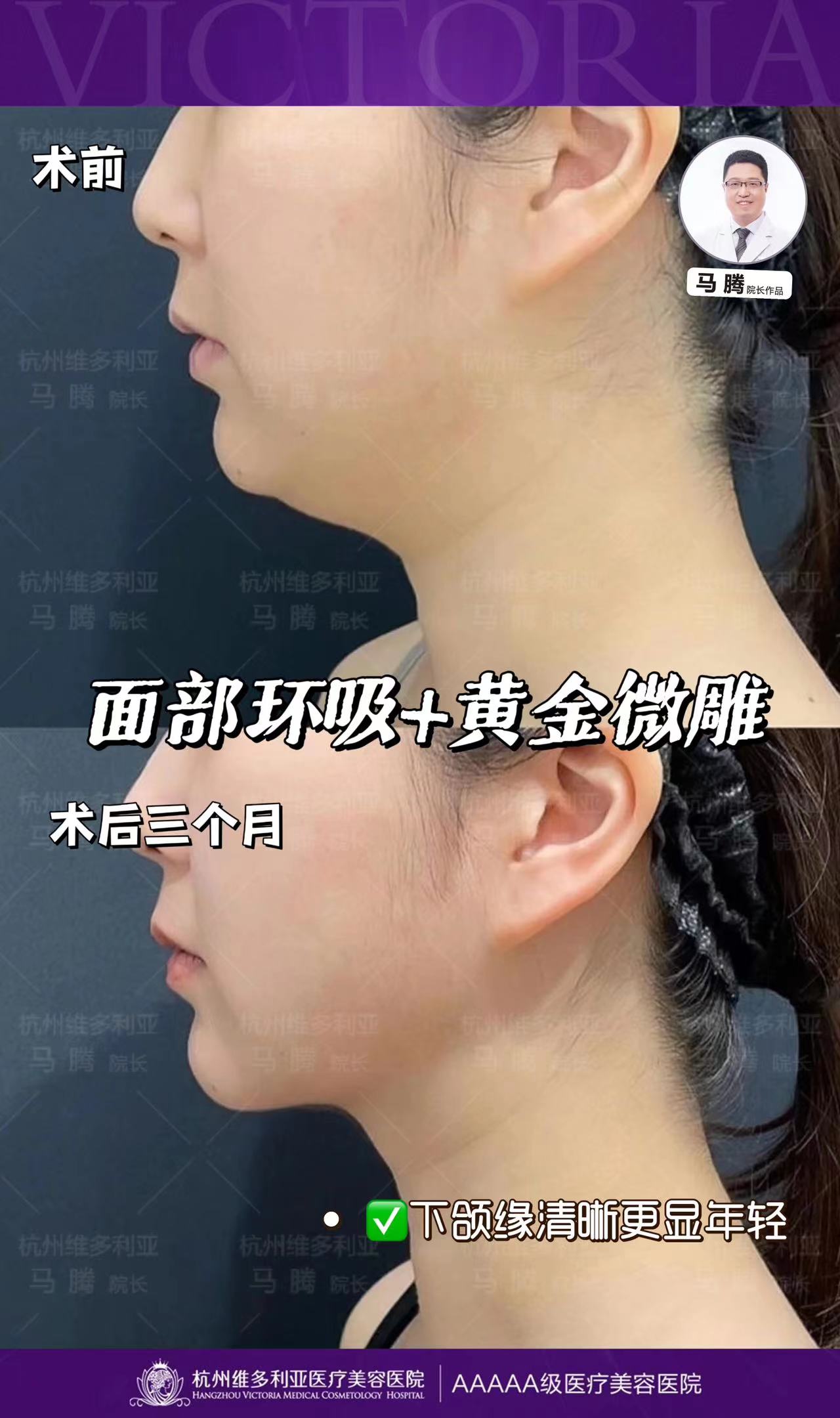 二、杭州维多利亚整形医院