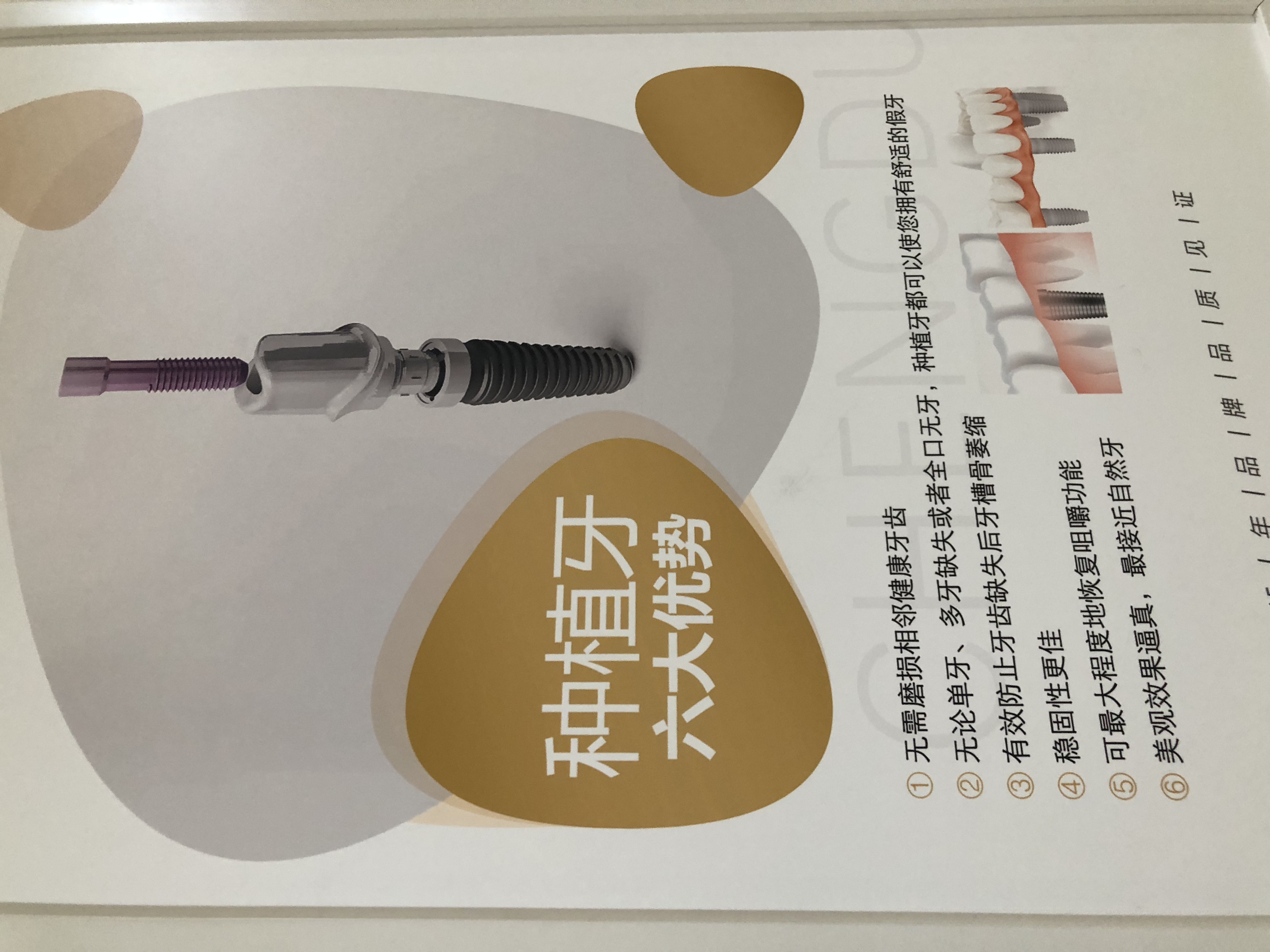 四、成都团圆口腔