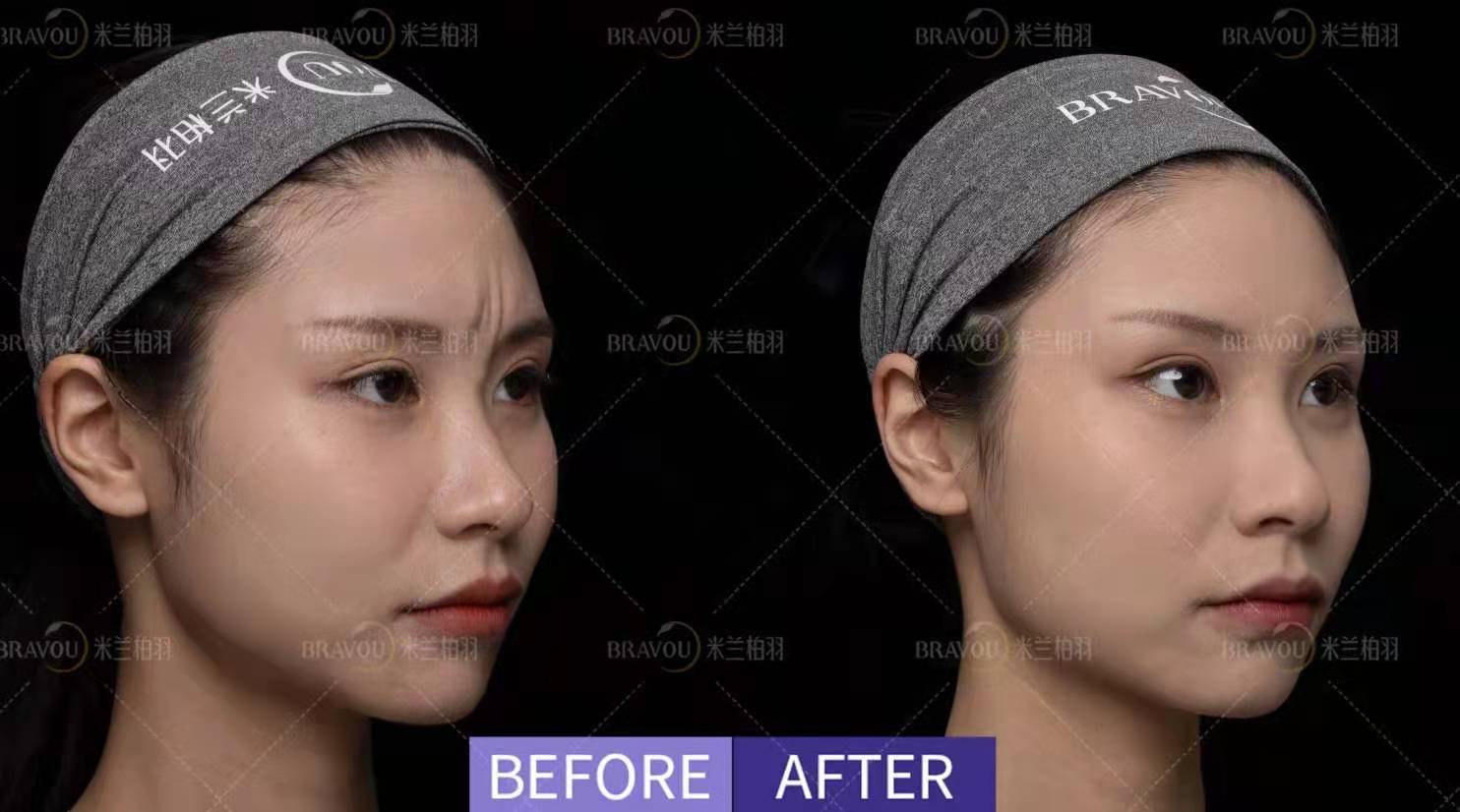 三、成都米兰柏羽医学美容医院