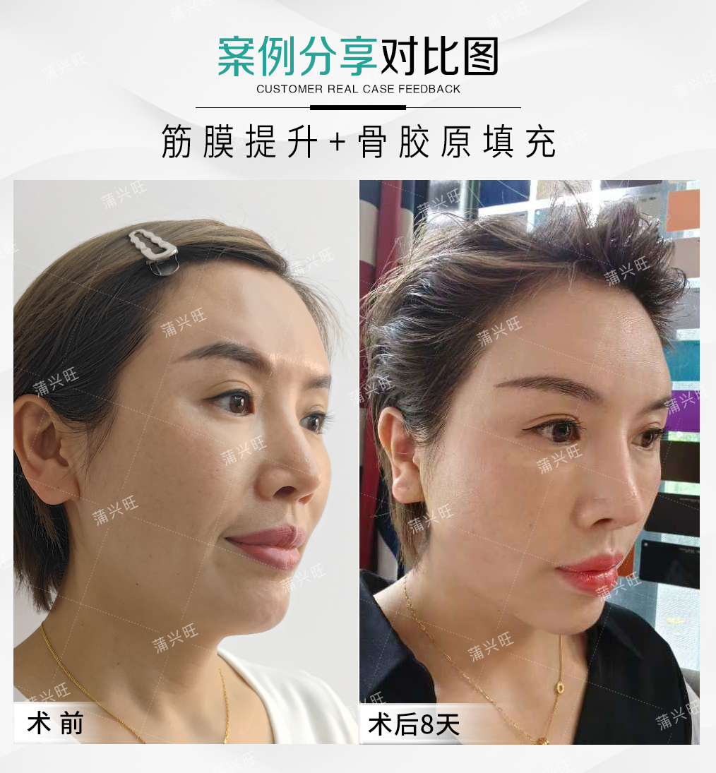 五、成都懿和唯美医疗美容医院