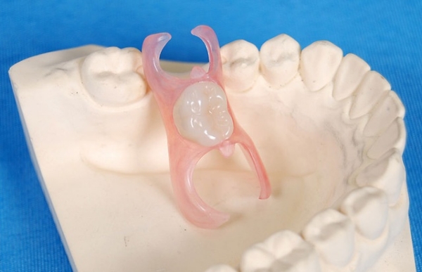 二、影响杆卡式种植覆盖义齿价格的关键因素