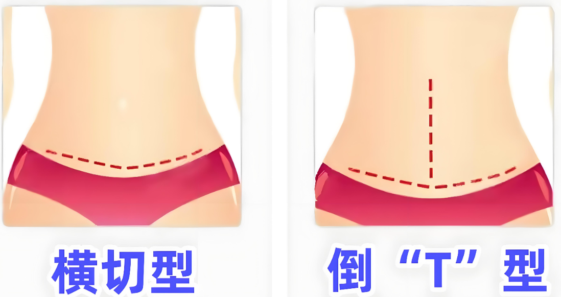 九、其他项目：价格因需求而异