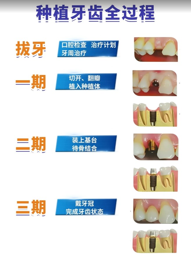 二、影响诺贝尔cc价格的多个关键因素