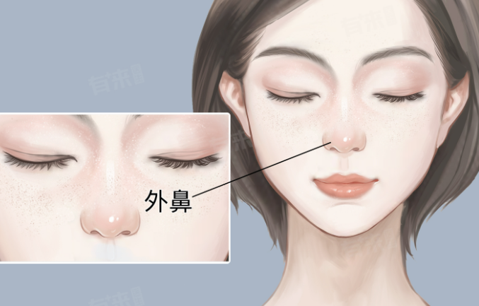 三、爱贝芙注射鼻基底的注意事项与术后护理