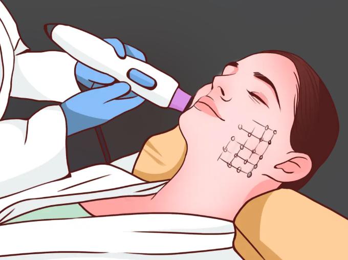 二、热玛吉的价格范围