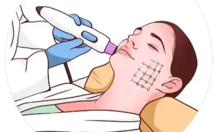 五、黑钻超声炮多少钱?影响价格的关键因素