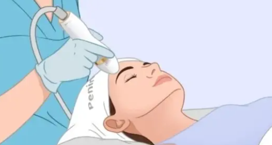 四、黑钻超声炮多少钱?不同套餐价格差异明显