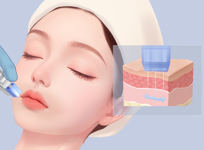 二、润致娃娃水光疗效怎么样？与其他产品的对比