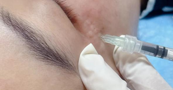 三、润致谁打过疗效好吗？用户反馈真实可靠