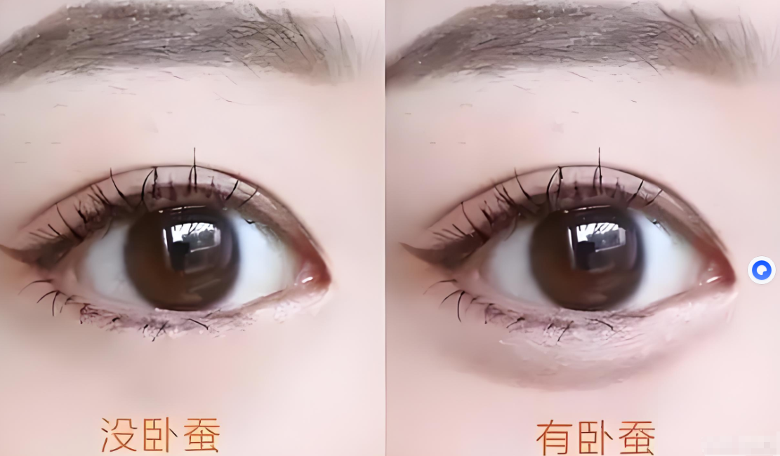 四、打卧蚕要多少钱？其他影响因素与注意事项