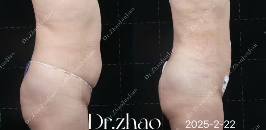 三、北京奥尔贝德王阔远的面部修复价格体系