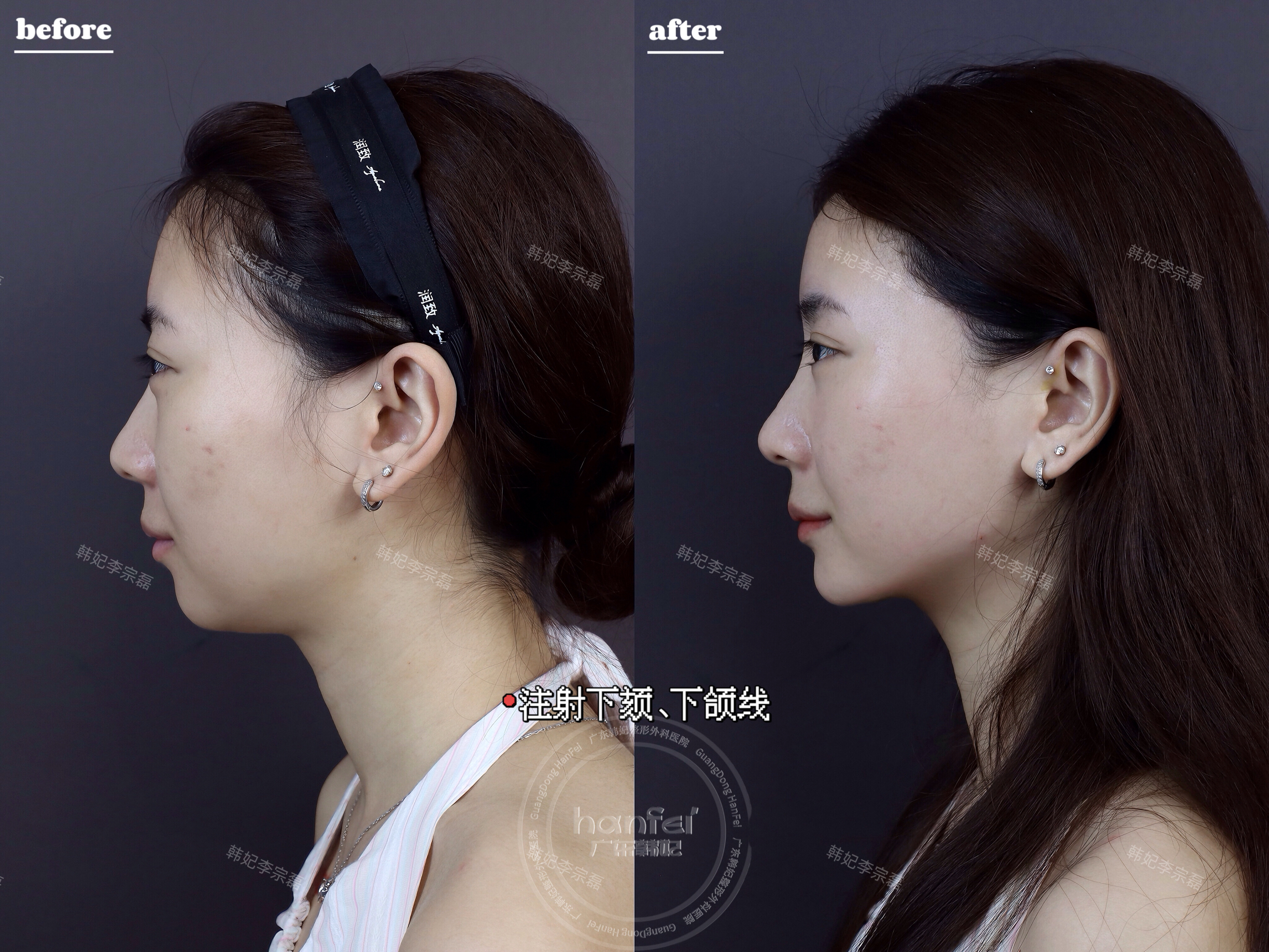 八、广州韩妃疤痕修复科