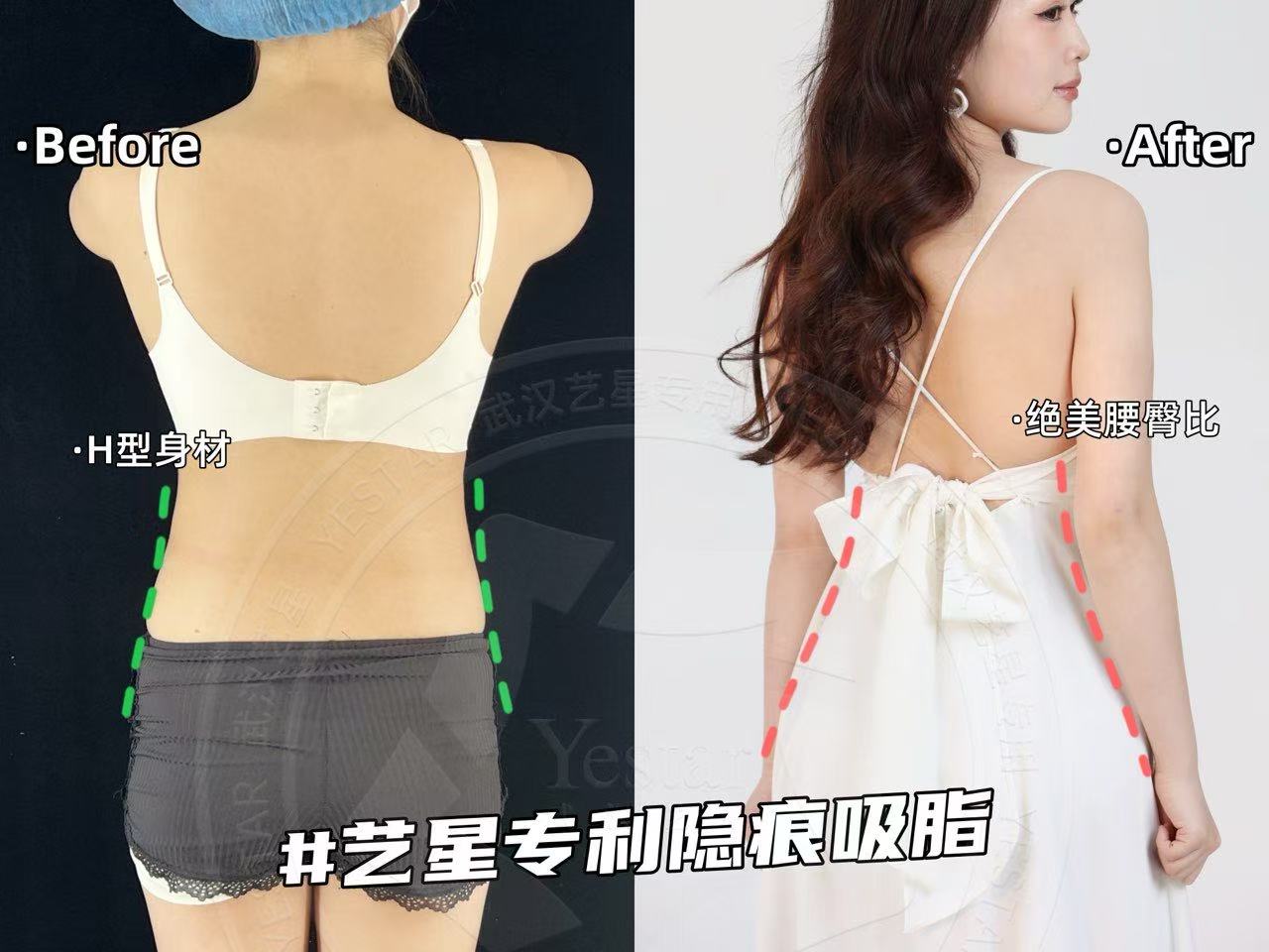 三、武汉艺星医疗美容医院