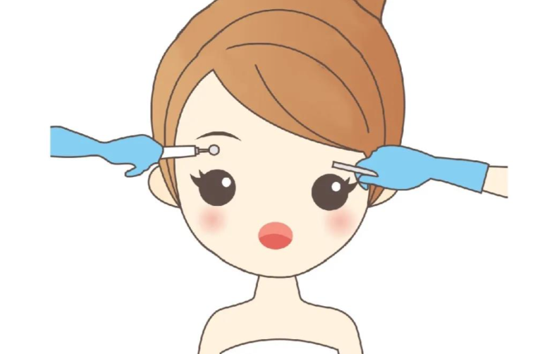 五、眉毛种植：价格区间在20–35元/毛囊单位