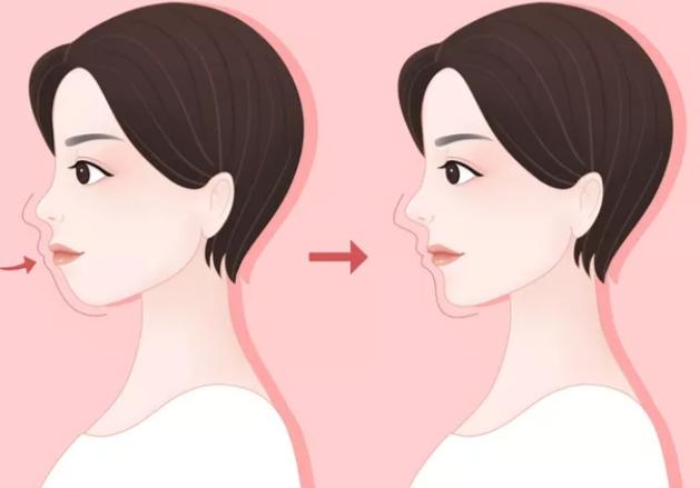 四、柳春明正颌手术价格在什么范围