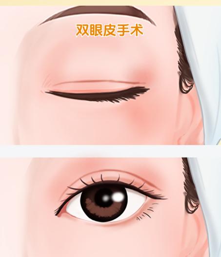 集美整形刘德辉做眼修复靠谱吗？超万例经验+无痕技术，7天消肿自然如妈生！