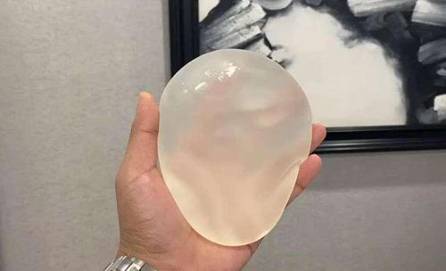 三、真实实例对比:水滴形与圆形假体的实际疗效